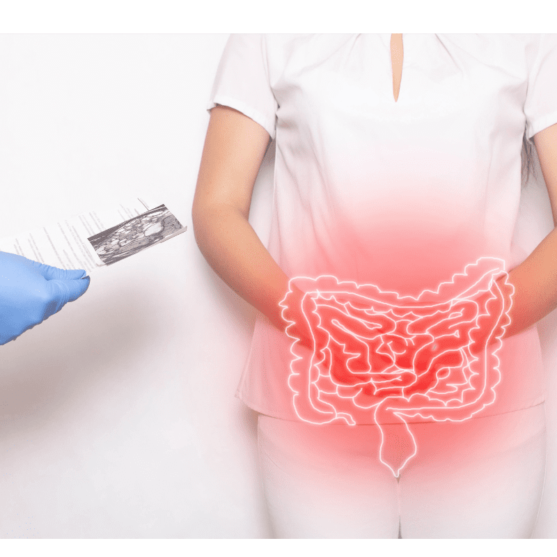 causas de la disbiosis